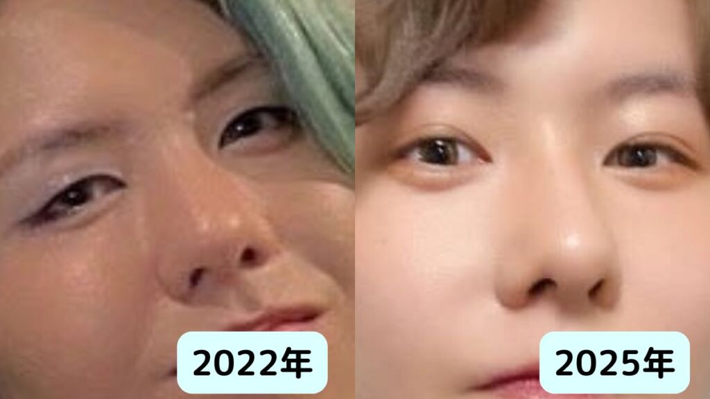 ミセス藤澤涼架は整形?鼻が高い理由と二重幅はいつからか