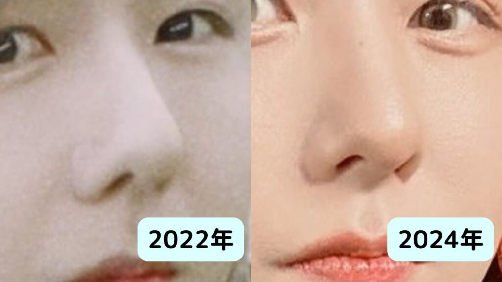 ミセス藤澤涼架は整形?鼻が高い理由と二重幅はいつからか