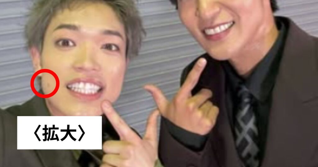 Timeleszの原嘉孝はほくろ取ったのかメイクなのか整形なのか画像で比較