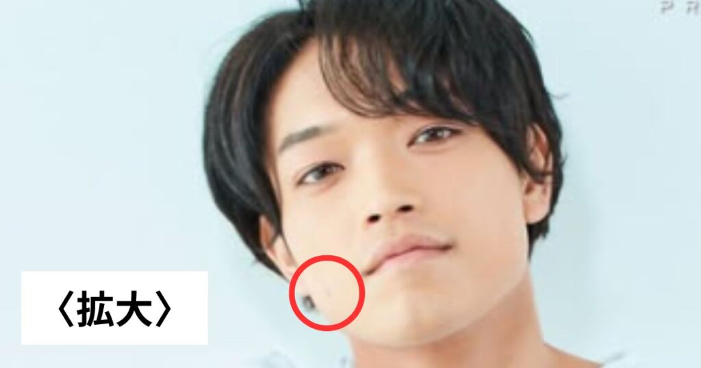 Timeleszの原嘉孝はほくろ取ったのか、メイクで隠しているのか整形で取ったのか
