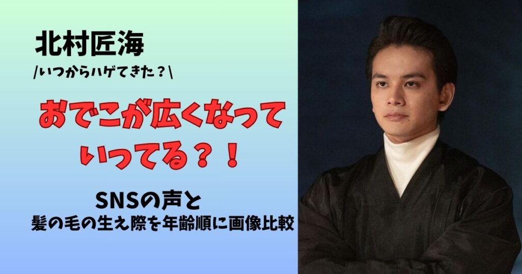 北村匠海のおでこが広い?いつからハゲてきてSNSの声は?髪の毛の生え際を年齢順に画像比較